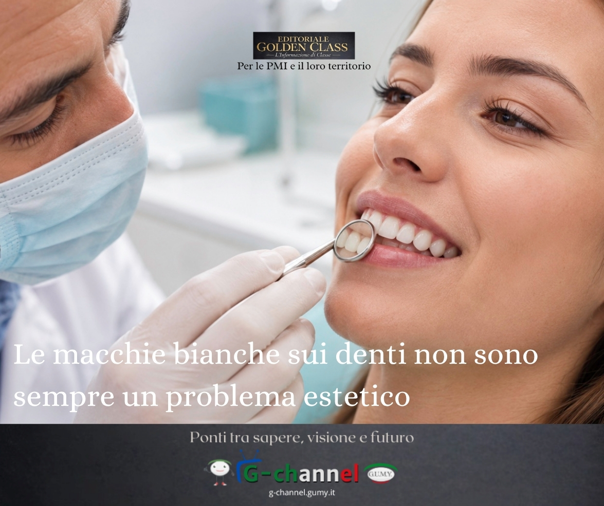 Le macchie bianche sui denti non sono sempre un problema estetico